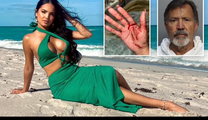 JUST IN:TikTok star Eixchel Berroteran nearly murdered by stepdad in horrifying attack: 'Only God knows why I am still here'..Read More Here