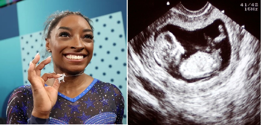 BREAKING NEWS: Fox News just reported that Gold Medalist Simone Biles Is Pregnant at the 2024 Olympics. “3 weeks gone”… See more