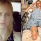 Tragedy strikes: American model loses legs and almost dies despite proper tampon use! …see more