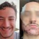 Mathieu Vigier Latour, a 24-year-old student from France, tragically ended his life after an unsuccessful beard transplant.