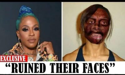 20 Black celebrities Who RUINED Their Careers With PLASTIC SURGERY. Watch more