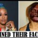 20 Black celebrities Who RUINED Their Careers With PLASTIC SURGERY. Watch more