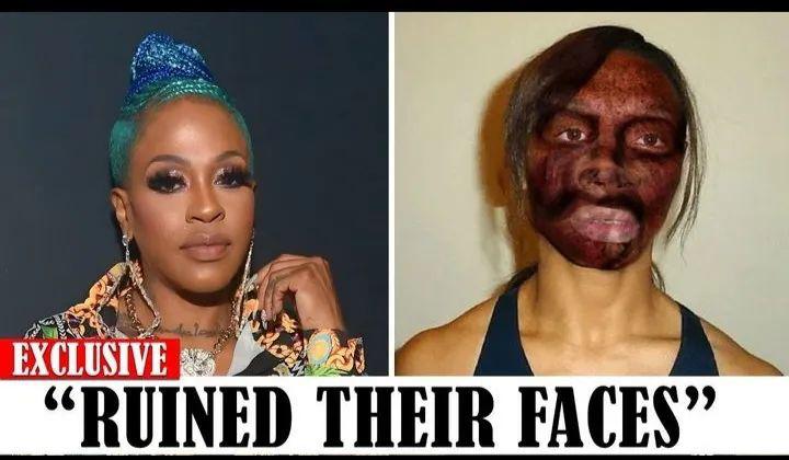 20 Black celebrities Who RUINED Their Careers With PLASTIC SURGERY. Watch more