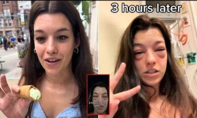 “Crazy”: Woman Ends Up In The ER With Swollen Face After Visiting Pickle-Themed Food Festival.What was in that festival that led to….see more