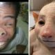 How pitiful!!! Pig-faced person, can anyone explain this phenomenon to me? I heard they had this problem because their mother ate something while pregnant, apparently… see more