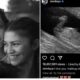 PREGNANT: ZENDAYA reveals she’s expecting with SPIDEY star TOM HOLLAND, the couple announces plans for a… See more.